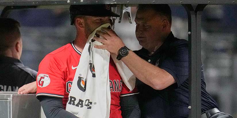 Guardians' David Fry sustains broken nose and facial fractures after being hit in face by pitch