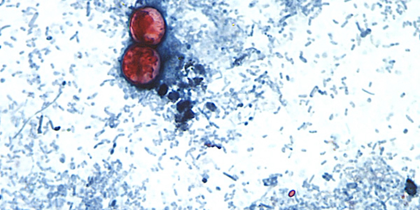 Canada is not banning produce imports amid U.S. cyclosporiasis outbreak, CFIA says